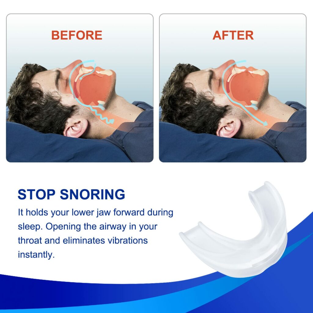 Hypoallergenic Improved Breathing For Anit- Snoring Mouth